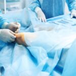 Синдром діабетичної стопи