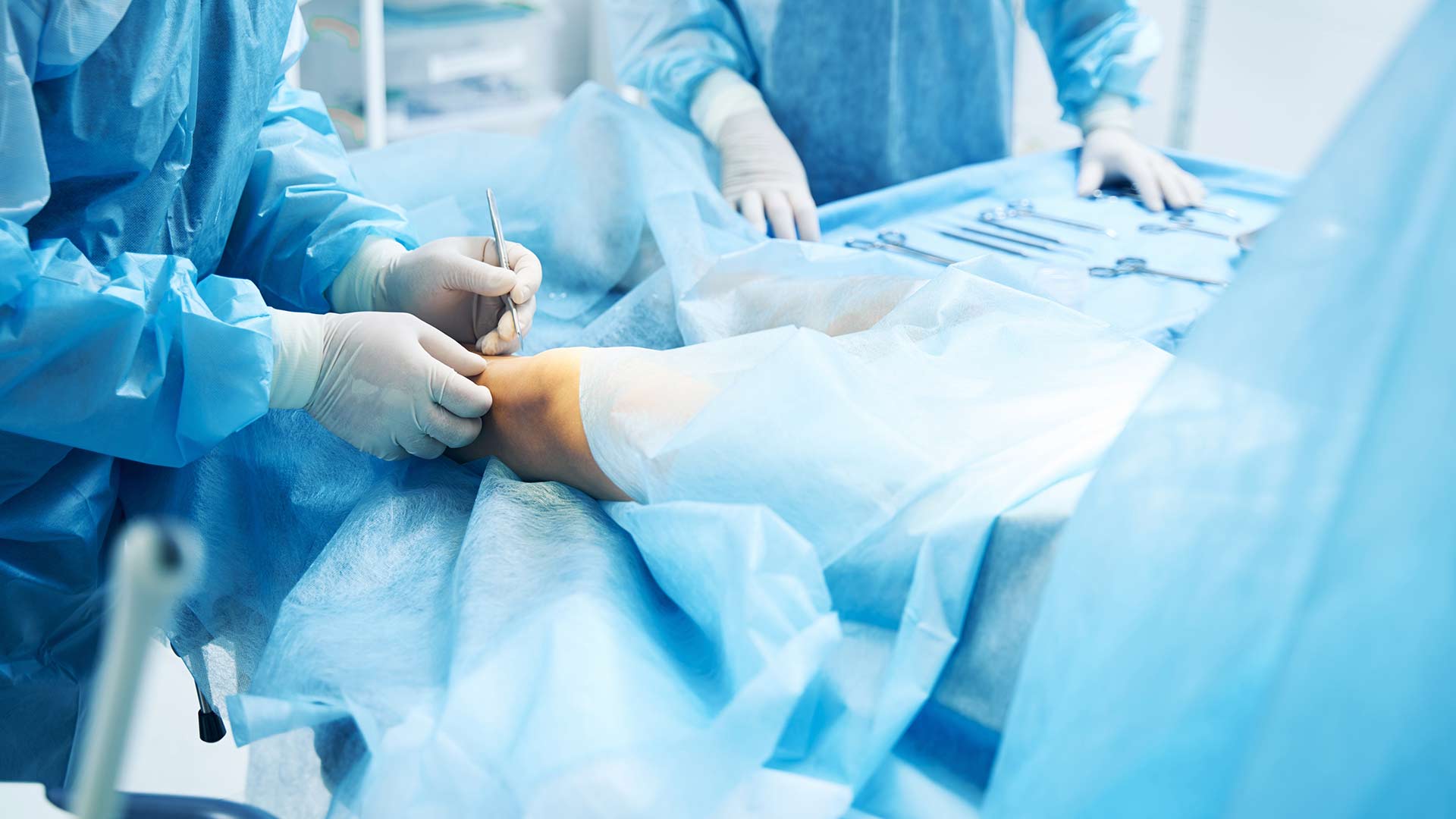 Ви зараз переглядаєте Синдром діабетичної стопи