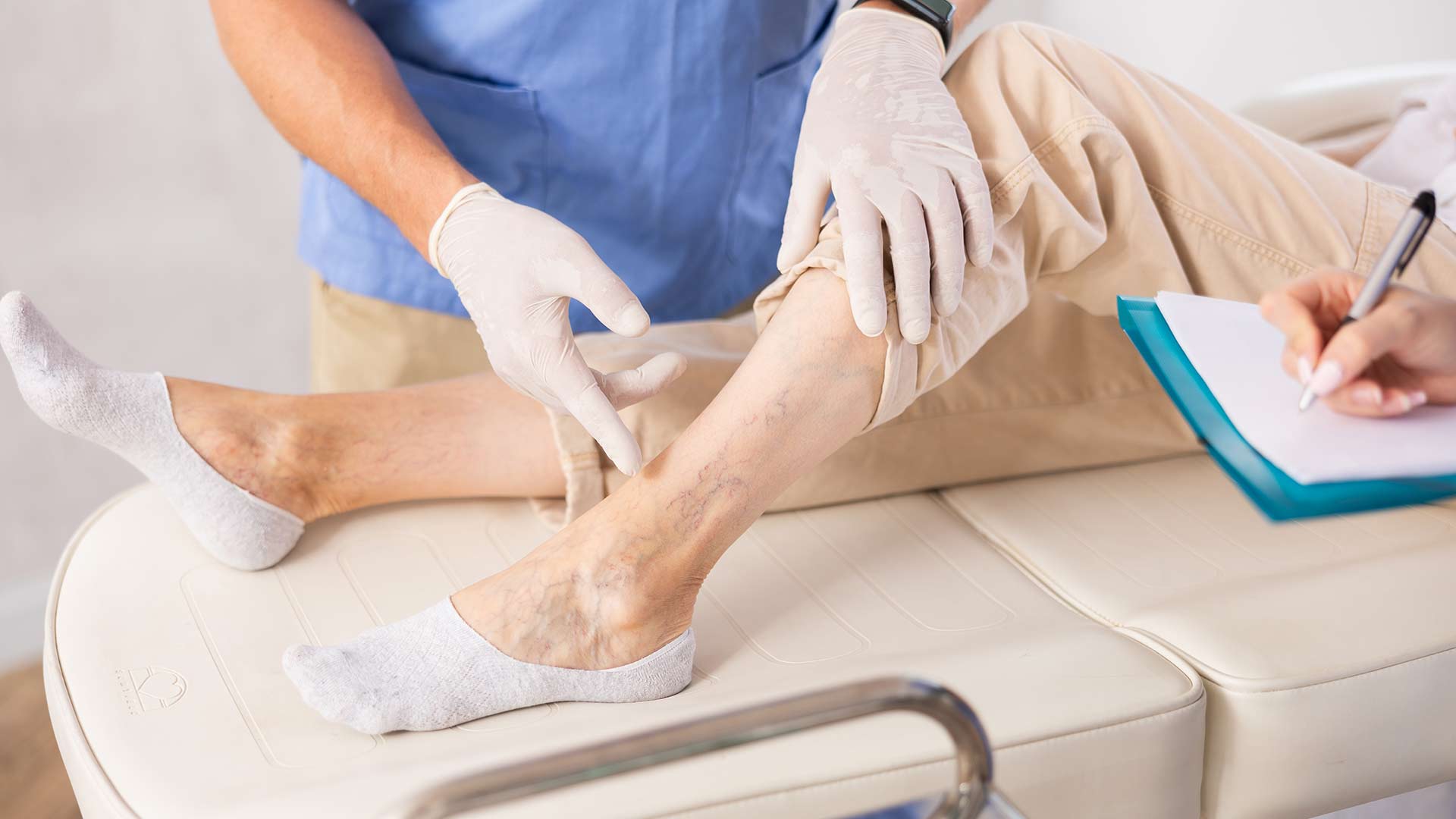 Ви зараз переглядаєте Ретикулярний варикоз