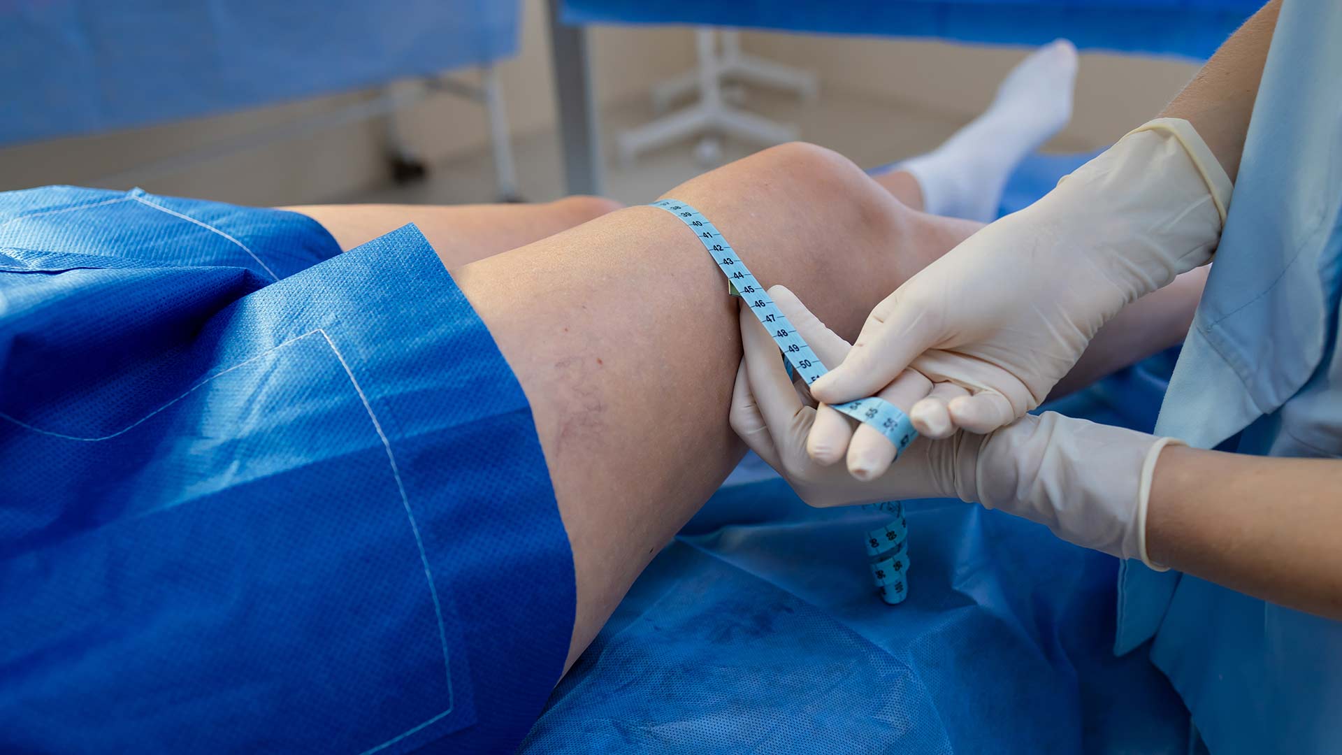 Детальніше про статтю Лімфостаз (лімфедема) нижніх кінцівок